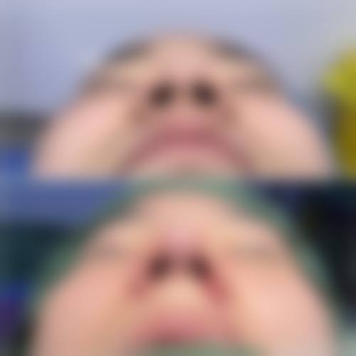 宁波同仁医院腋臭整形科预约挂号方式。