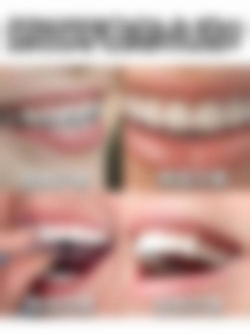 滁州凤阳县爱牙乐口腔(凤凰路店)地理位置便于到院。