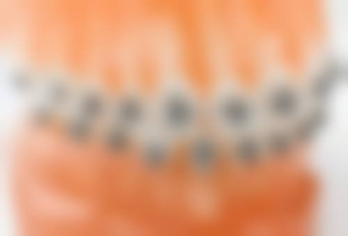 格伦菲尔口腔（龙华清湖总院）擅长项目。