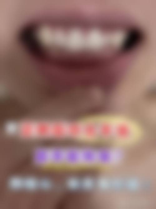 格伦菲尔口腔（龙华清湖总院）治疗反馈与口碑评价。