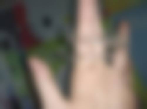 韩引利医生技术实力展现