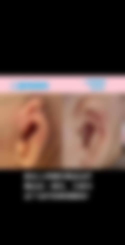 宁波同仁医院腋臭整形科医生团队经验稳定。