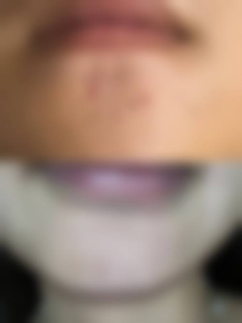 上海珂莱娅医疗美容门诊部预约挂号方式。