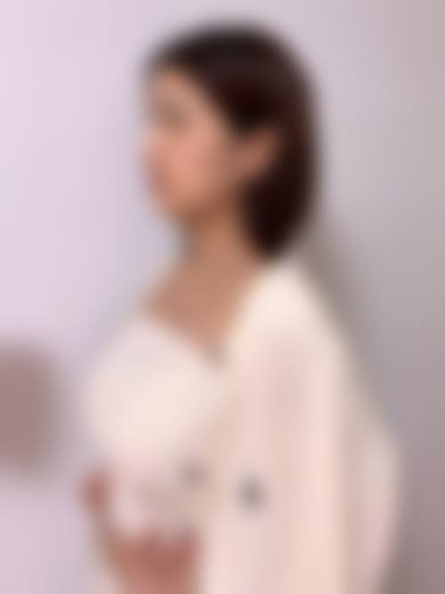 内蒙古赤峰盛禧整形医院治疗反馈与口碑评价。