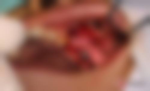 格伦菲尔口腔（龙华清湖总院）地理位置便于到院。