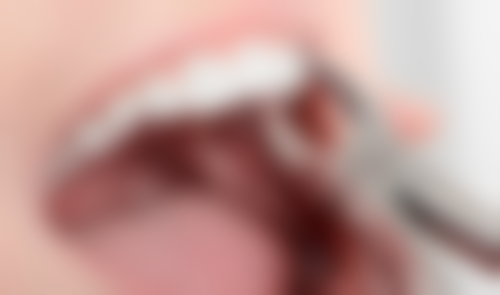 单小峰医生技术优势