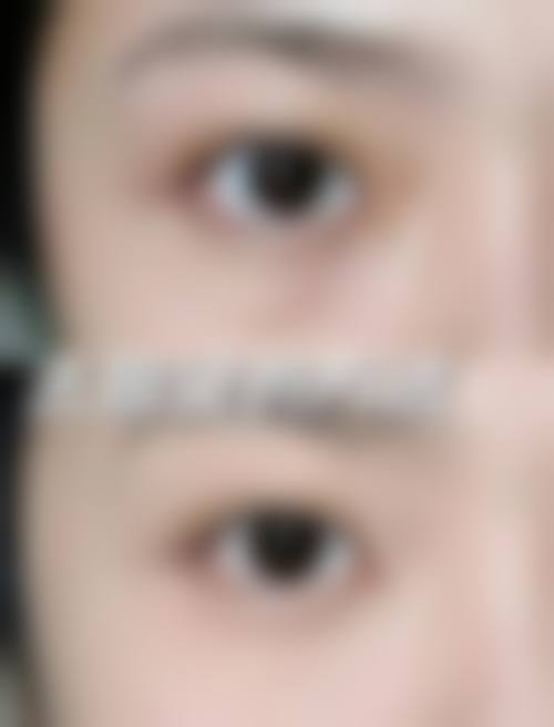 重庆佑安医疗美容诊所擅长项目。