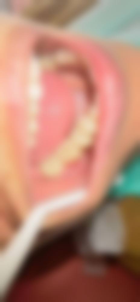 宁波海曙刘锦亚口腔诊所治疗反馈与口碑评价。