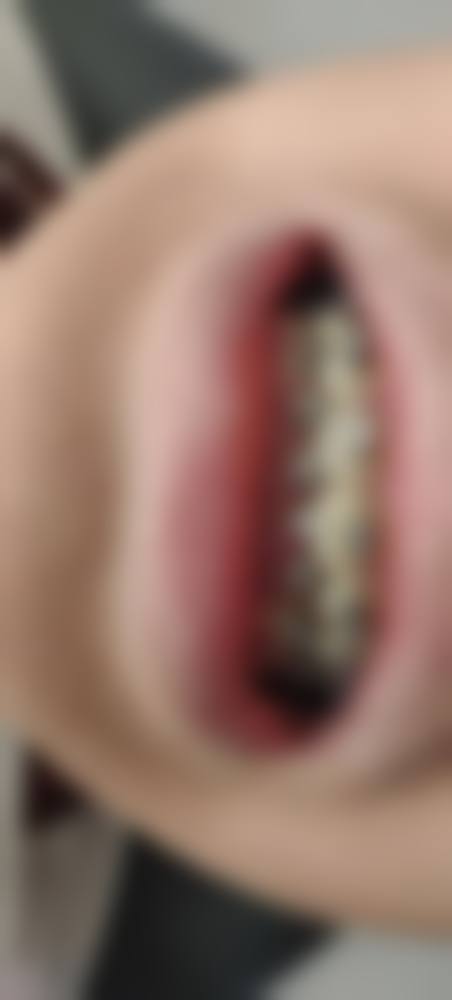 广东东莞恒美口腔门诊擅长项目。