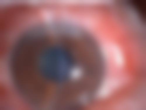 天津市宝坻区人民医院眼科治疗反馈与口碑评价。