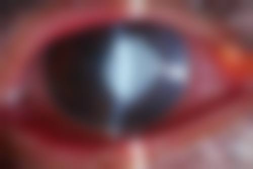 黄山歙县文慈眼科医院预约挂号方式。