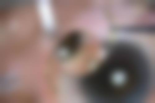 长春市恒达眼科医院治疗反馈与口碑评价。