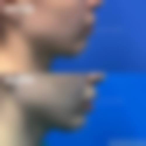 舟山妃斯整形医院擅长项目。