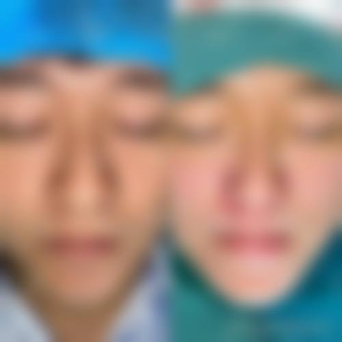 武汉西婵整形美容门诊部擅长项目。