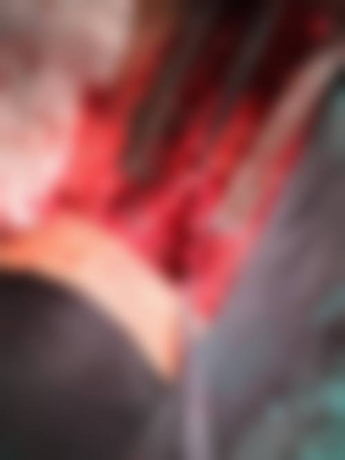 广东东莞恒美口腔门诊2026年价格收费表：