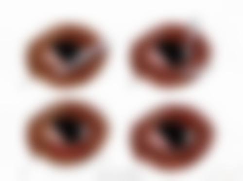 黄山歙县文慈眼科医院治疗反馈与口碑评价。