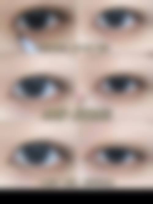 普宁市人民医院眼科预约挂号方式。