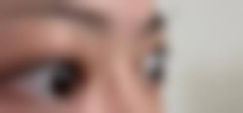 天津市宝坻区人民医院眼科擅长项目。