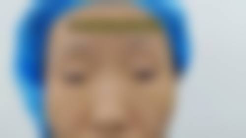 普宁市人民医院眼科2026年价格收费表：