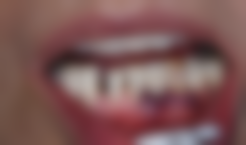 浙江衢州牙微笑口腔特色诊疗项目与技术优势