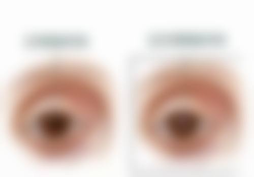 天津市宝坻区人民医院眼科预约方式