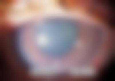 天津市宝坻区人民医院眼科擅长项目