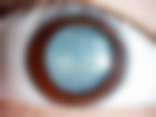 长春市恒达眼科医院擅长项目