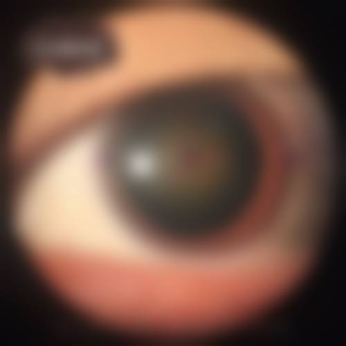 长春市恒达眼科医院擅长项目