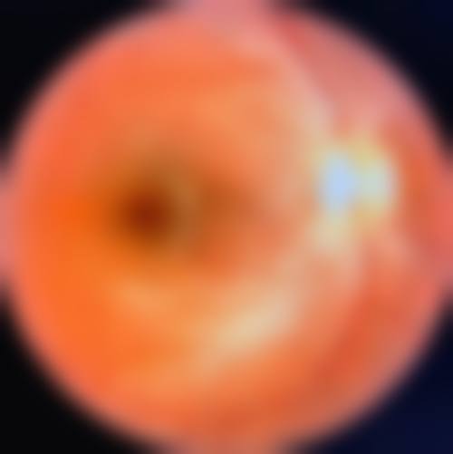 天津市宝坻区人民医院眼科擅长项目