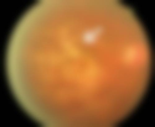 刘会娟医生擅长项目