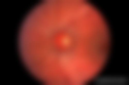 天津市宝坻区人民医院眼科设备情况