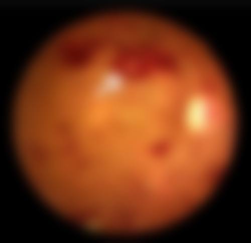 彭秀芹医生的技术实力