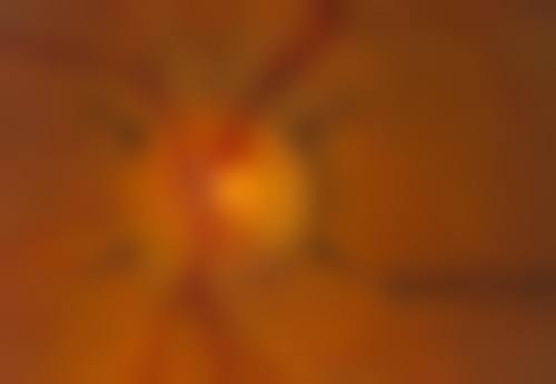 锦州市中 心医院眼科治疗反馈与口碑评价。