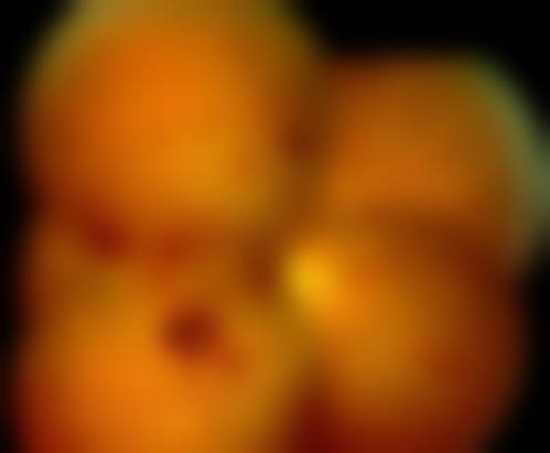 锦州市中 心医院眼科地理位置便于到院。