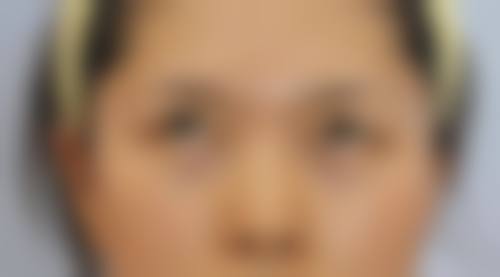 重庆杨东运医疗美容诊所2026年价格收费表：