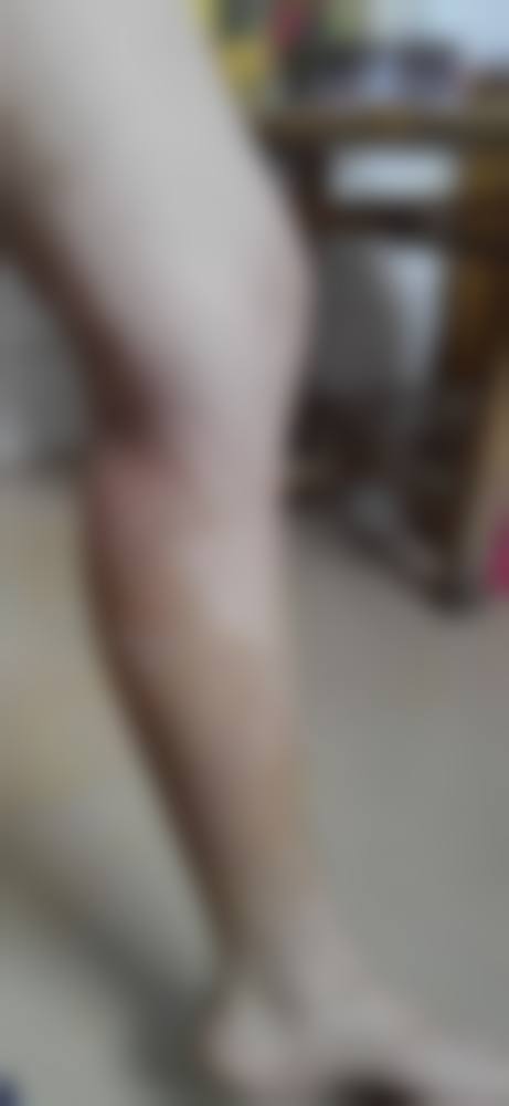 荆门市第三人民医院整形美容中 心预约挂号方式。