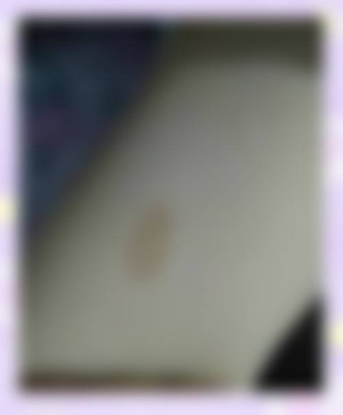 荆门市第三人民医院整形美容中 心擅长项目。