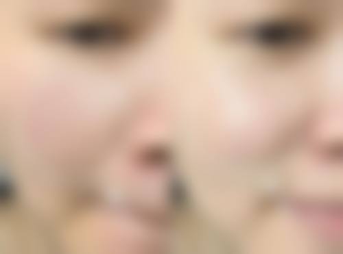 重庆杨东运医疗美容诊所治疗反馈与口碑评价。