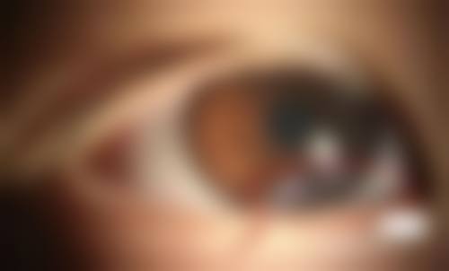 锦州市中 心医院眼科擅长项目。