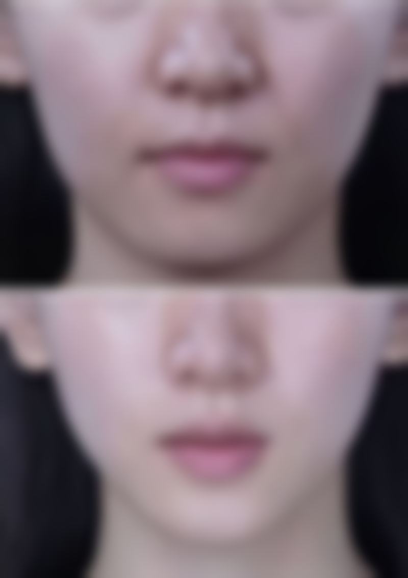 舟山妃斯整形医院设备优势