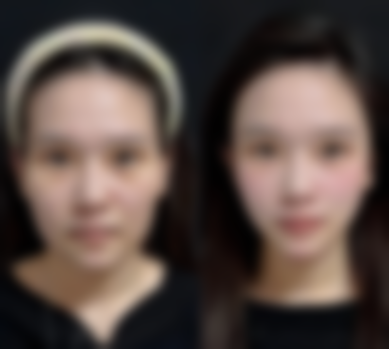 李艳莲医生坐诊医院