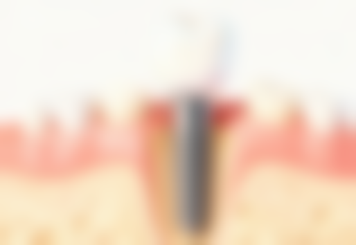 南京仁杉口腔(金鹰海内外店)收费价格表