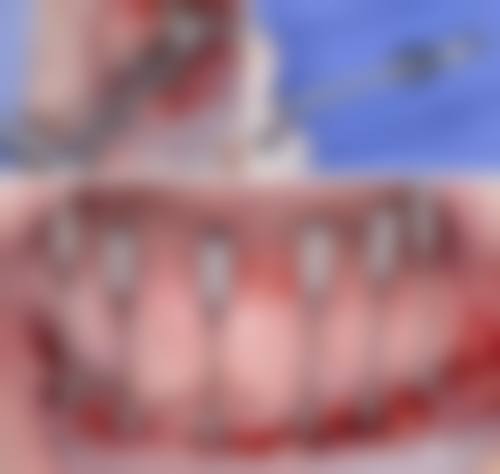 江苏泰州胡庆忠口腔擅长项目。