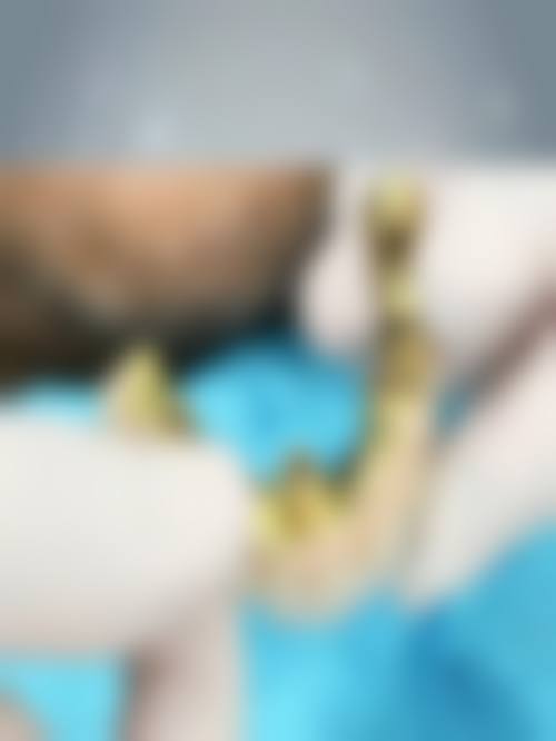 江苏泰州胡庆忠口腔医生团队经验稳定。