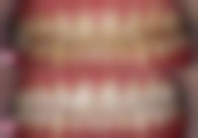 淮安瑞齿固德口腔诊所擅长项目。