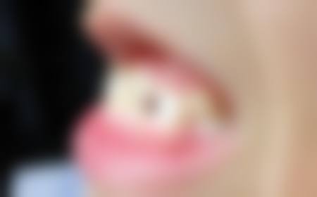 徐微微的技术实力体现