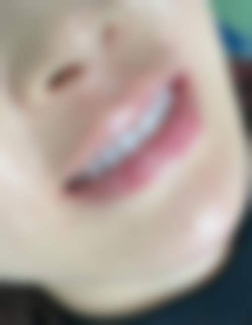 德阳爱牙口腔诊所特色诊疗项目与技术优势