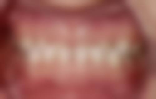 江苏泰州胡庆忠口腔治疗反馈与口碑评价。