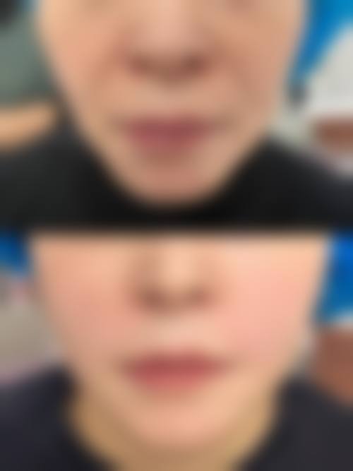 青州华恩医疗美容诊所医生团队经验稳定。