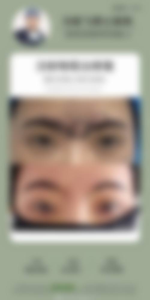 青州华恩医疗美容诊所擅长项目。